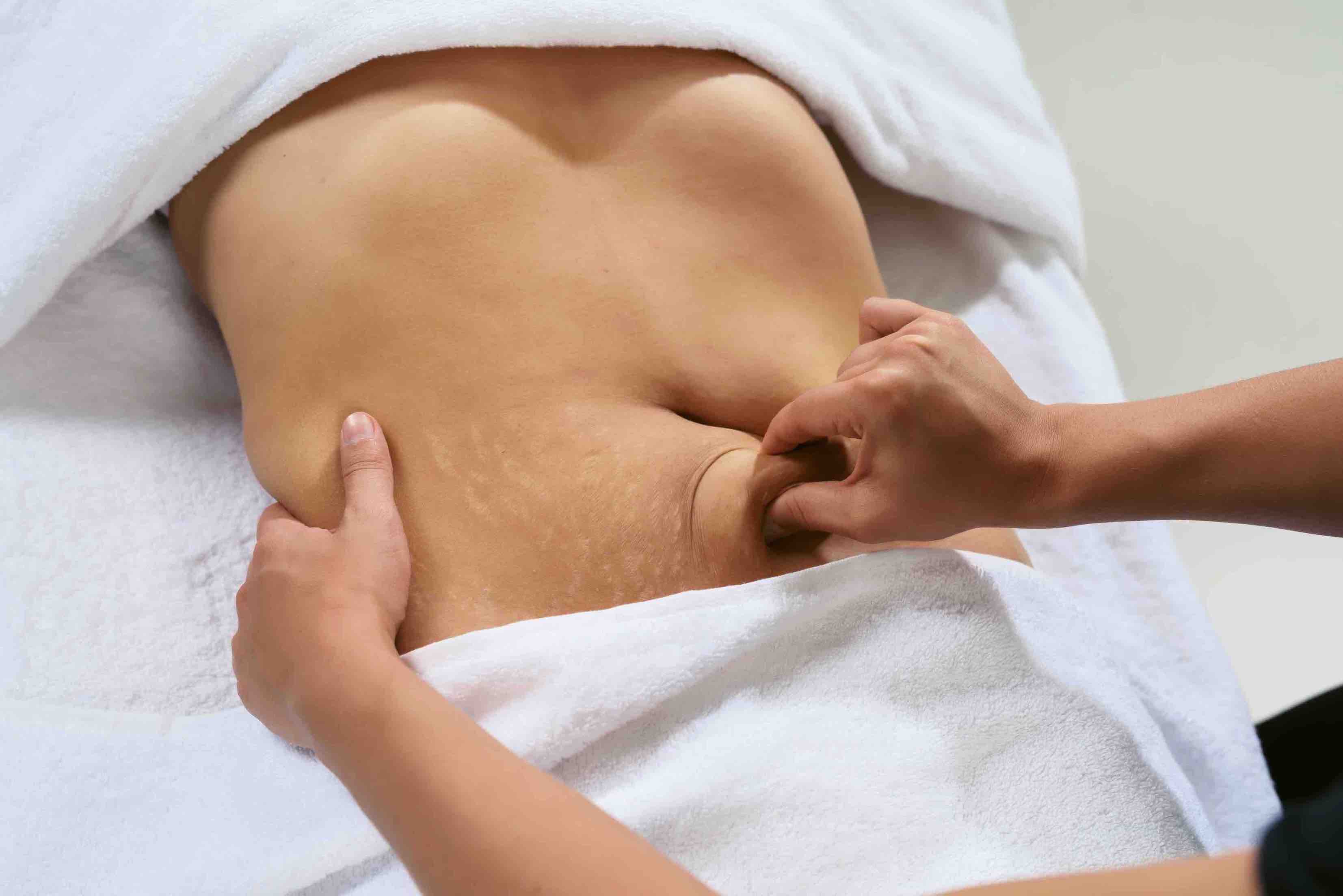loose belly skin after weight loss corrective surgery brisbane