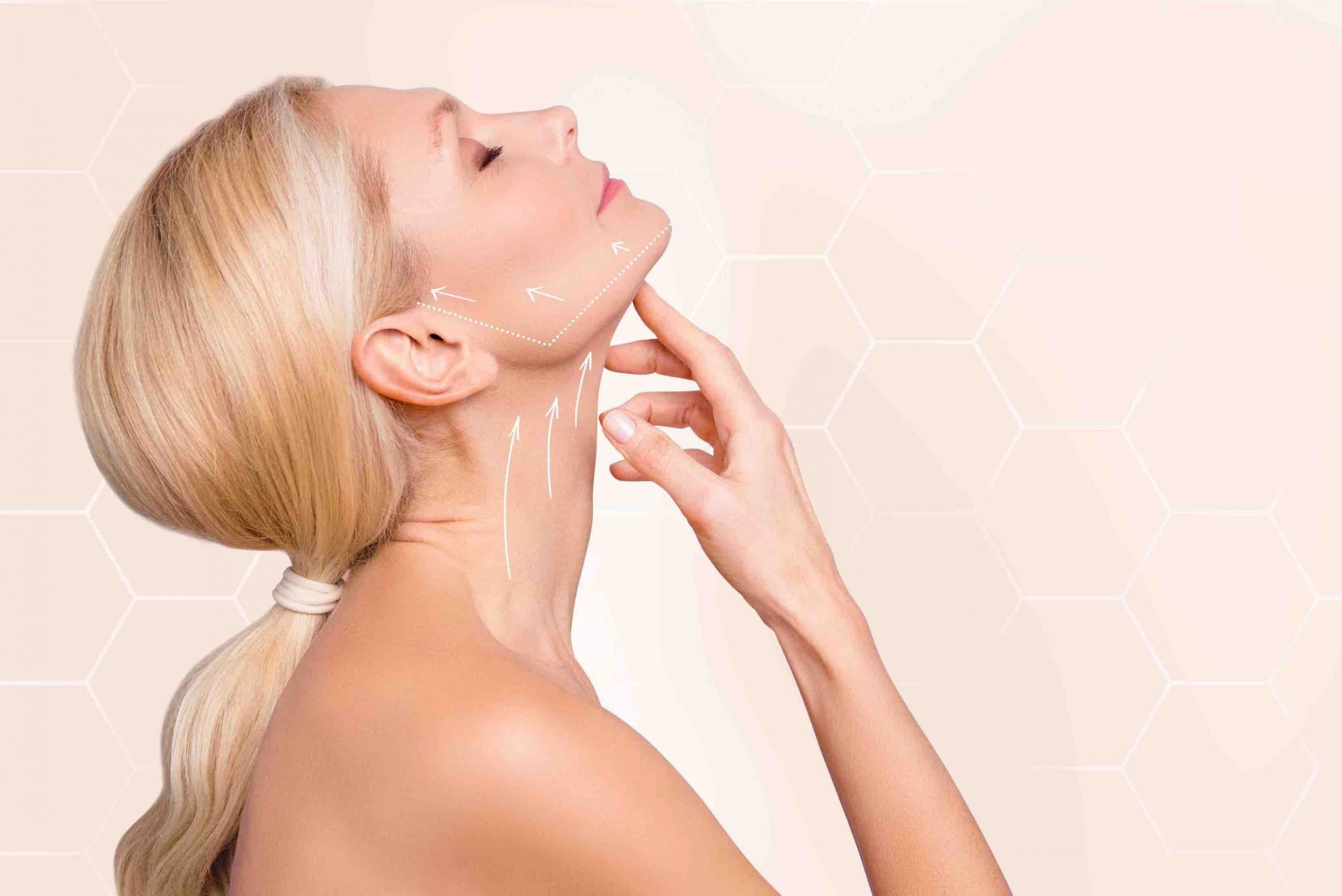neck lift brisbane