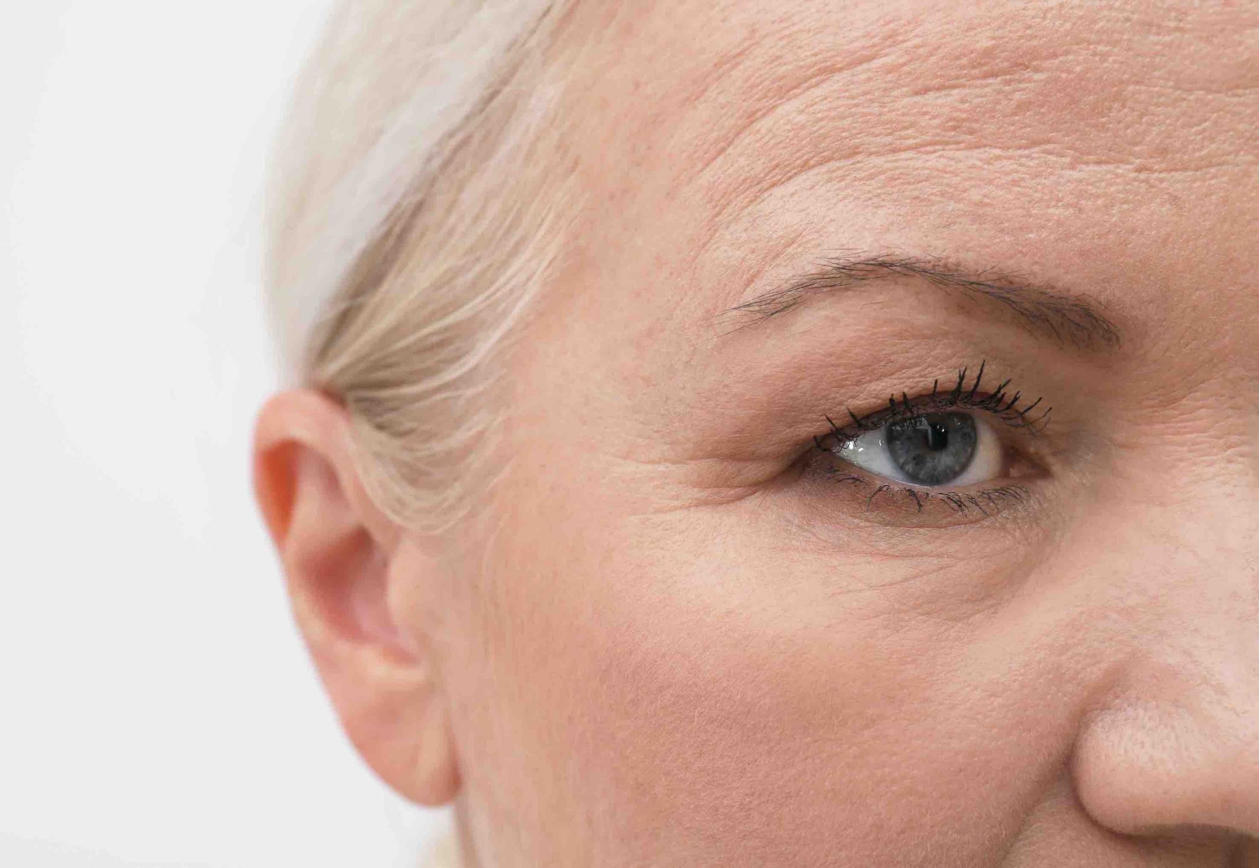 under eye bags treatment
