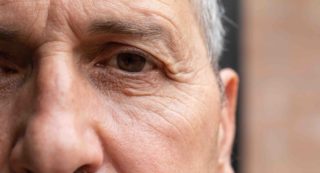 Will Medicare Cover My Eyelid Surgery?