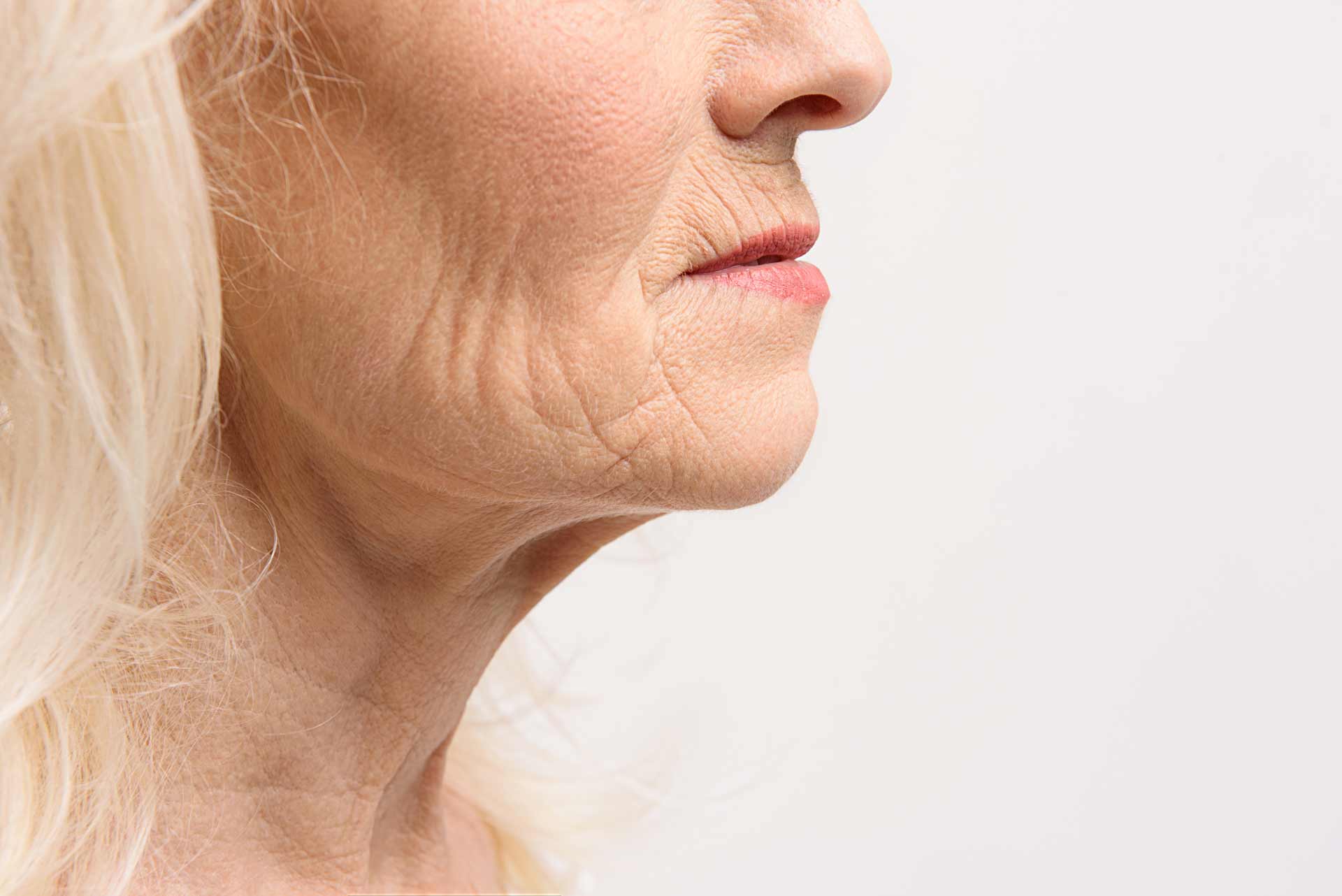 saggy neck treatment gold coast